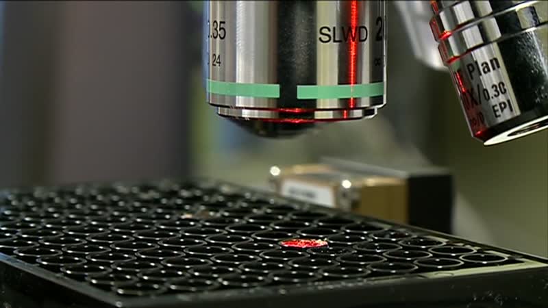 El hospital implementará la posibilidad de diagnosticar Alzhéimer con un pinchazo