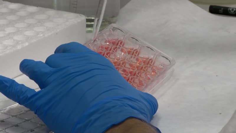 El CIC tiene en marcha 49 grandes proyectos de investigación contra la enfermedad